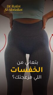 بتعاني من الخفسات اللي مزعجتك؟
في حل بسيط وسريع باستخدام حقن الدهون الذاتية

📍الموقع: مجمع الزنبقة الطبي، شارع ابن خلدون (الخالدي)، ط5 - عمان
📞 للحجز والإستفسار: 0798672233