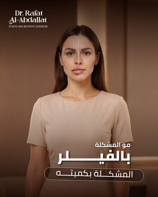 ليش بعض النتائج بتكون مبالغ فيها؟السبب غالبًا:• زيادة الكمية • اختيار مكان غير مناسب • غياب التوازن بين ملامح الوجه التجميل الصح = توازن ✨📩 احجزي استشارتك الآن وابدئي رحلتك بثقة📍الموقع: مجمع الزنبقة الطبي، شارع ابن خلدون (الخالدي)، ط5 - عمان📞 للحجز والإستفسار: 0798672233#دكتور_رأفت_العبداللات #فيلر #تجميل_الوجه #عيادات_التجميل #عمان_الأردن #جراحة_التجميل #جمال_طبيعي #فيلر_شفايف #فيلر_طبيعي